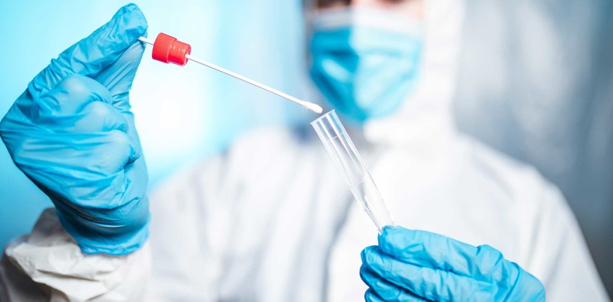 Abschaffung der kostenlosen Corona-Tests auch für Österreich?