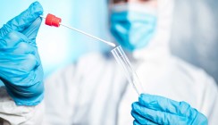 Abschaffung der kostenlosen Corona-Tests auch für Österreich?