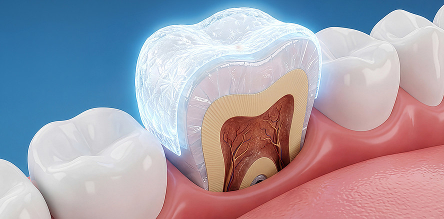 Offener Brief: Prof. Michael J. Noack widerspricht „Beyond Fluoride“-Initiative