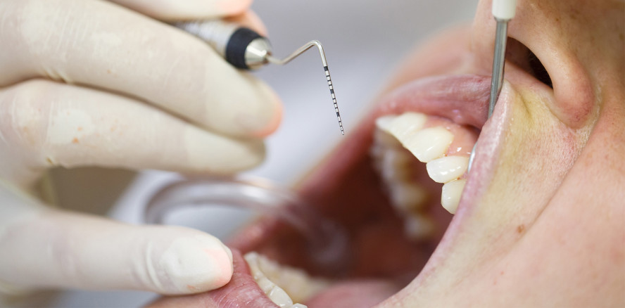 Happy Birthday: Ein Jahr neue Parodontitis-Richtlinie