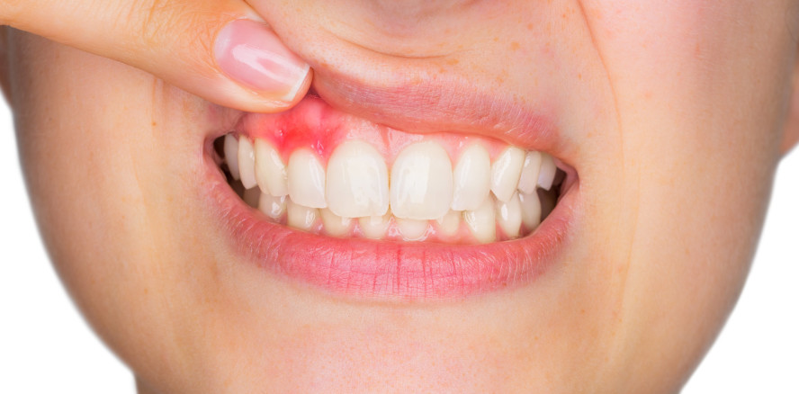 PAR-Richtlinie: Neue Leistungen beschlossen