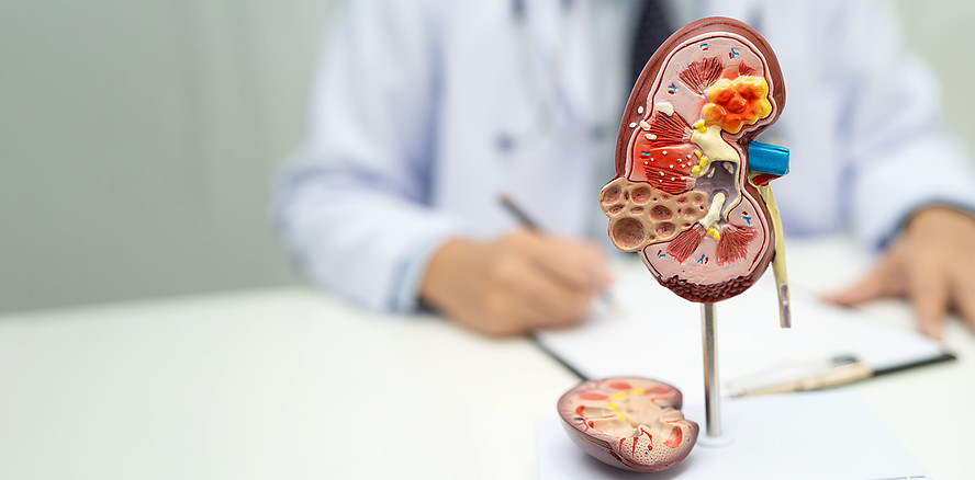 Parodontitis und Nierenerkrankungen: Studie zeigt enge Wechselwirkung