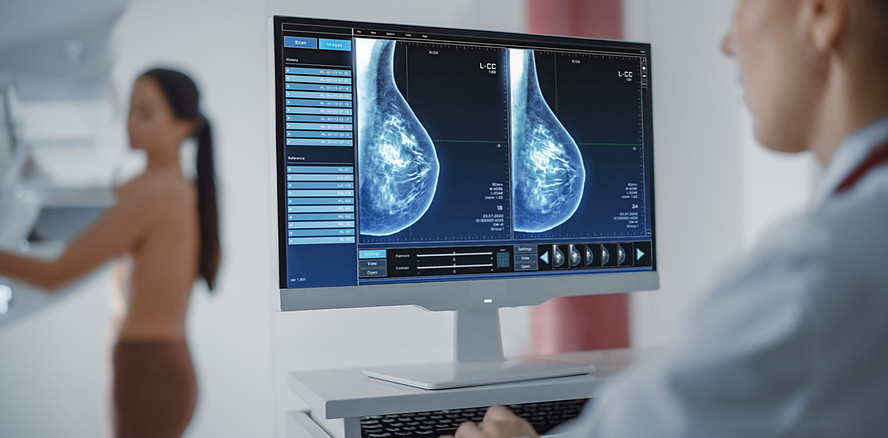 Fusobacterium nucleatum – Parodontaler Erreger im Brustgewebe entdeckt