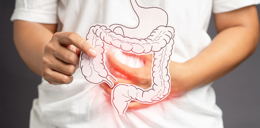 Höheres Parodontitis-Risiko bei entzündlichen Darmerkrankungen