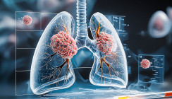 Schwere Parodontitis erhöht das Lungenkrebsrisiko bei Älteren