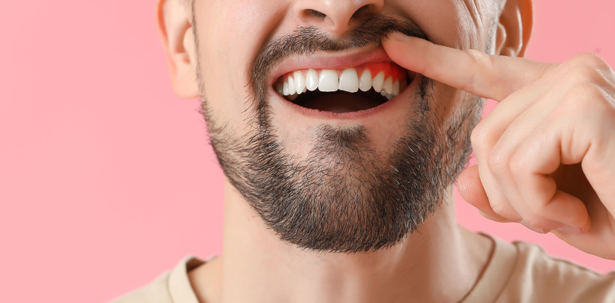 Neue, präventionsorientierte Parodontitistherapie retten!