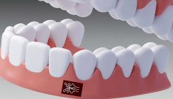 Statt Sonde & Co.? Neues Pflaster soll Parodontitis erkennen