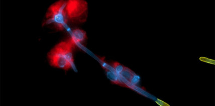 Immunsystem hält Pilz auf Schleimhaut in Schach