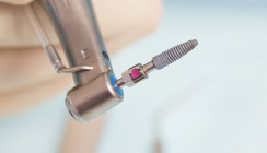 Propolis statt Chlorhexidin? Natürliche Substanzen in der Implantatreinigung