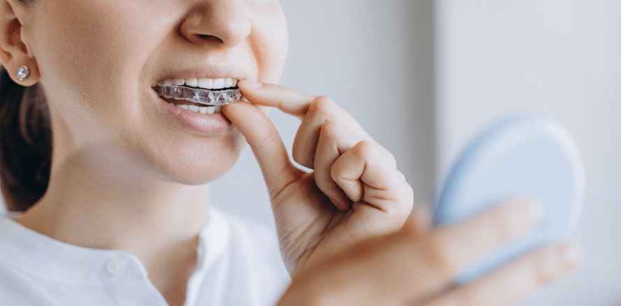 Scheinbetrieb bei Dr. Smile? Kammer warnt vor berufsrechtswidriger Zusammenarbeit