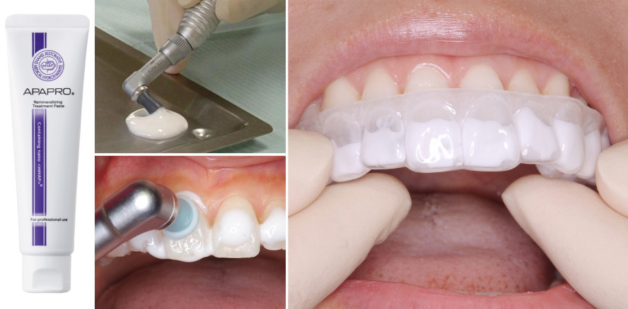 Hydroxyapatit-Zahnpasten von SANGI Co. auf der IDS 2023