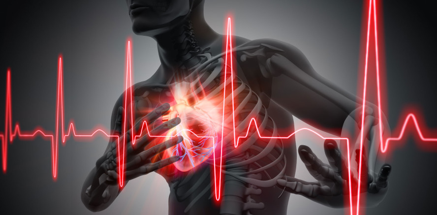 Erhöhtes Herzinfarkt- und Schlaganfall-Risiko durch Parodontitis