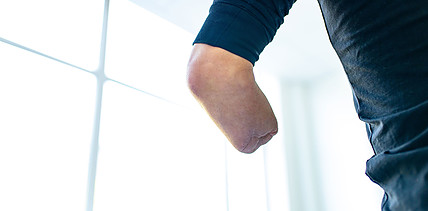 Septischer Schock nach Zahnarztbesuch: Patient verliert Arme und Beine