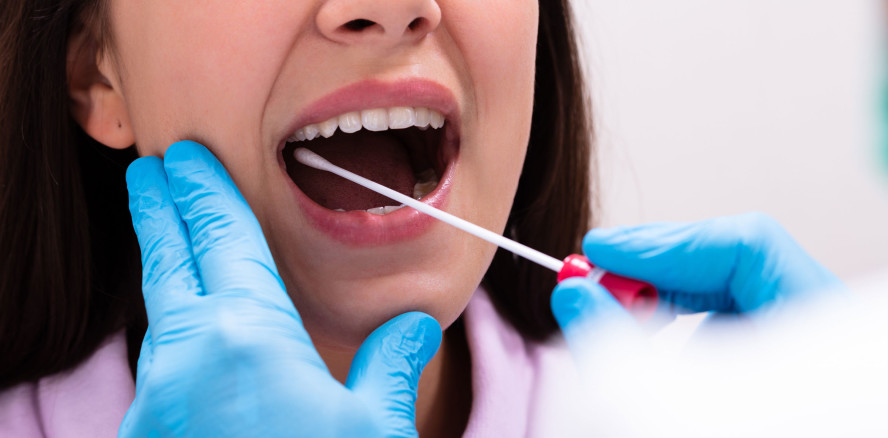 Speicheltest zur frühzeitigen Erkennung von Schlaganfällen