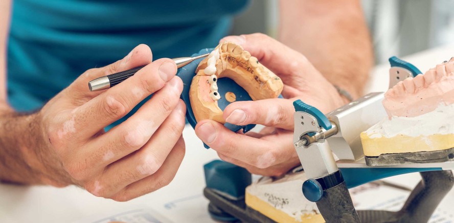 Handlungsbedarf: Stressbelastung im Zahntechnikerhandwerk