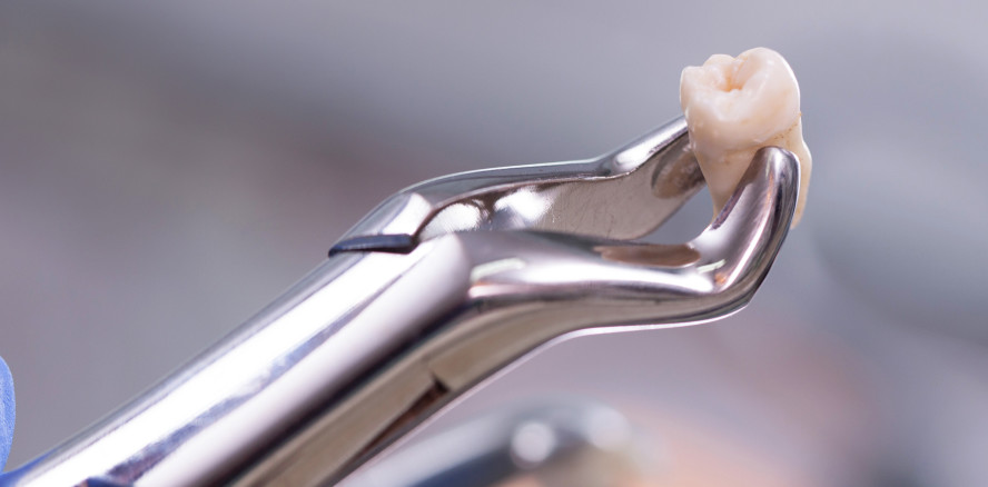 Mithilfe von KI Zahnverlust vorhersagen