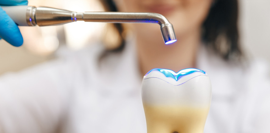 Langzeitstudie: Anpassungsfähige Zahnfüllungen sind besser als starre