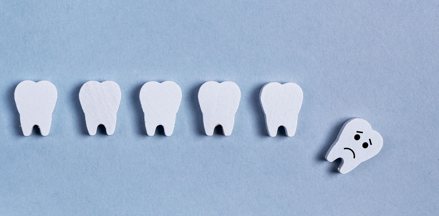 Zahnverlust schwächt Zungenkraft und erhöht das Bakterienrisiko