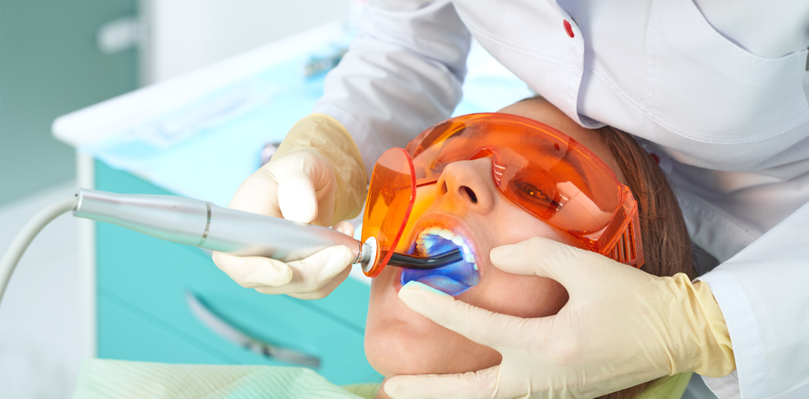 Neue Erkenntnisse zur Langlebigkeit von Frontzahnrestaurationen