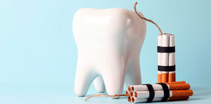 Tabakkonsum: Mundkrebs und Implantat-Verlust drohen