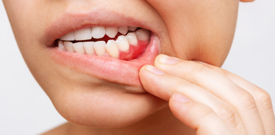 Am 12. Mai ist wieder europäischer Tag der Parodontologie