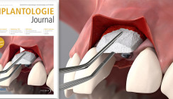 Jetzt online lesen: Oktoberausgabe des Implantologie Journal