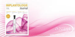 Aktuelles Implantologie Journal fokussiert Keramikimplantate