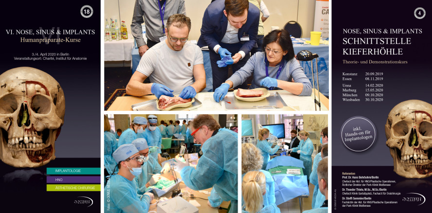 Nose, Sinus & Implants – Humanpräparate-Kurs 2020