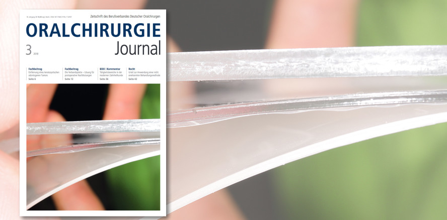 Aktuelles Oralchirurgie Journal jetzt online lesen