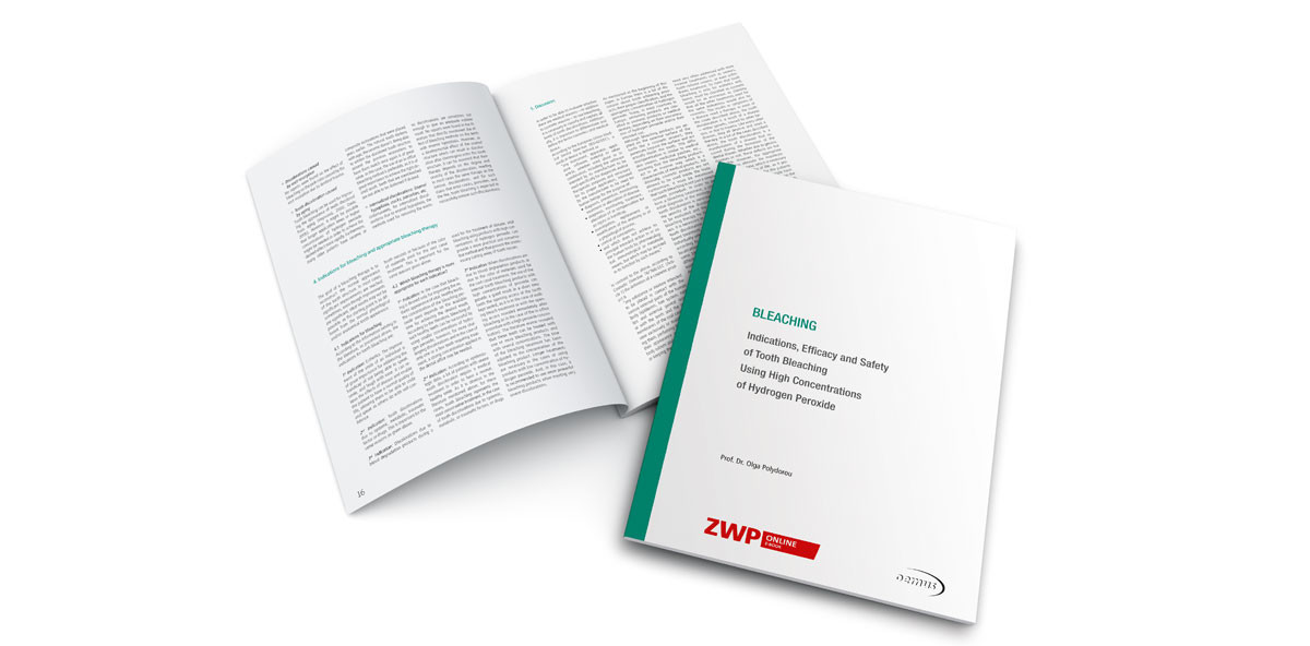 Neues eBook zum Thema Bleaching verfügbar