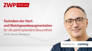 Techniken der Hart- und Weichgewebeaugmentation für die periimplantäre Gesundheit