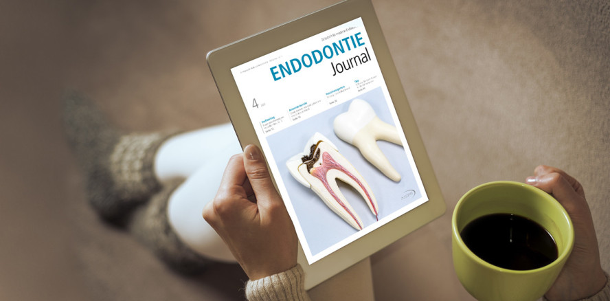 Aktuelles Endodontie Journal legt Fokus auf Instrumentenfraktur