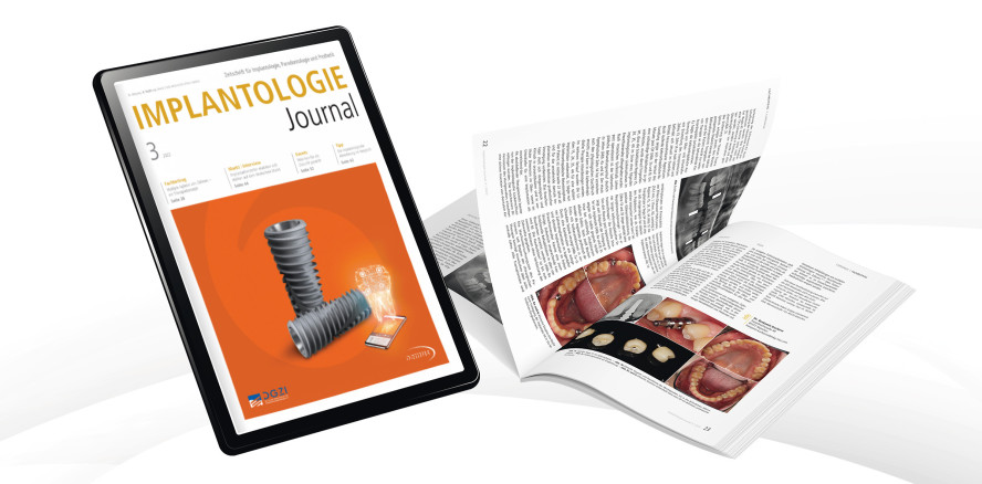 Aktuelles Implantologie Journal fokussiert das gesunde Implantat