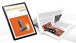 Aktuelles Implantologie Journal fokussiert das gesunde Implantat