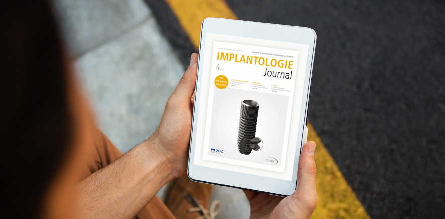 Aktuelles Implantologie Journal fokussiert Implantatprothetik