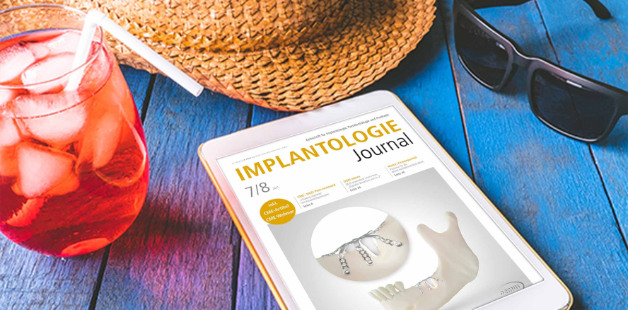 Aktuelles Implantologie Journal fokussiert Keramikimplantate
