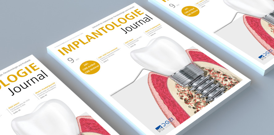 Neues Implantologie Journal mit thematischem Rundumschlag