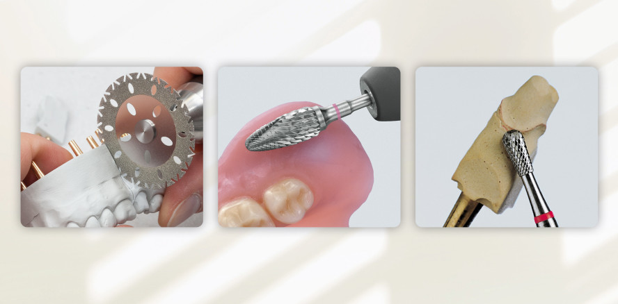 Step-by-Step: Das Freilegen der Präparationsgrenzen