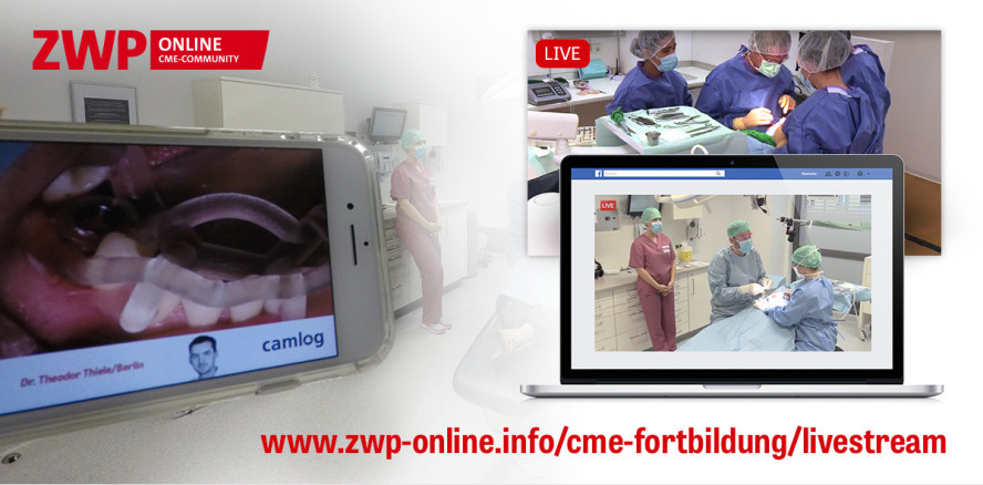 Live-OPs zum EUROSYMPOSIUM mit hoher Reichweite im Netz