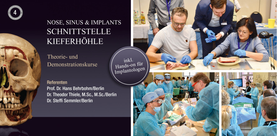 Schnittstelle Kieferhöhle – Humanpräparate-Kurse in 2020