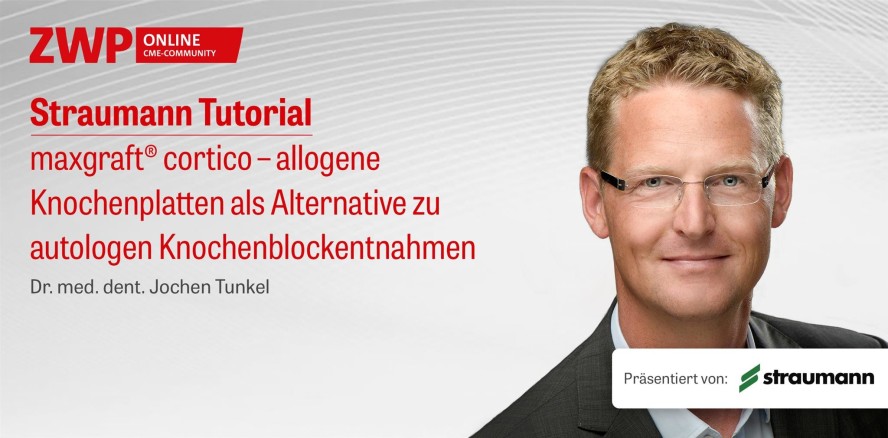 maxgraft® cortico – allogene Knochenplatten als Alternative zu autologen Knochenblockentnahmen