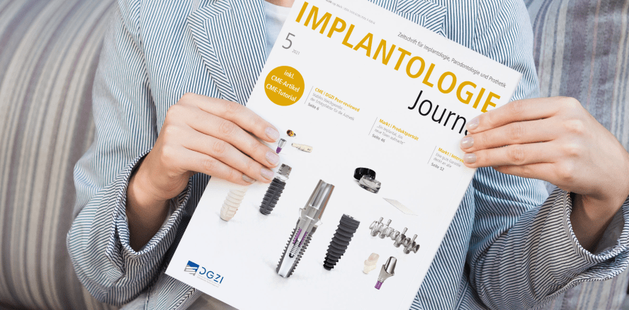 Update: GBR und GTR im aktuellen Implantologie Journal