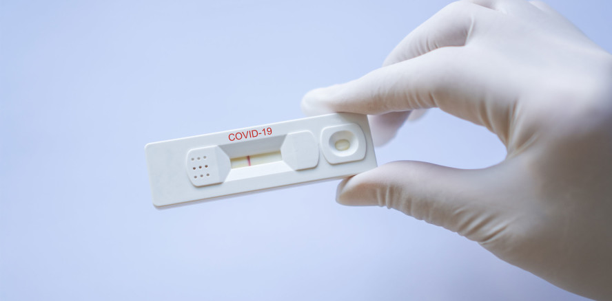 TestV: Zahnärzte dürfen testen – aber wen, wie oft und womit?