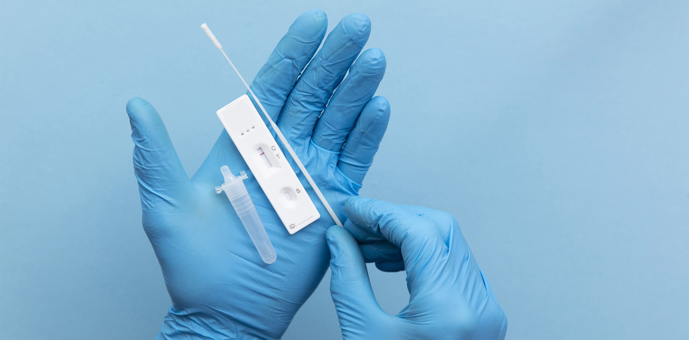 Keine kostenlosen Corona-Schnelltests nach Infektion mehr 