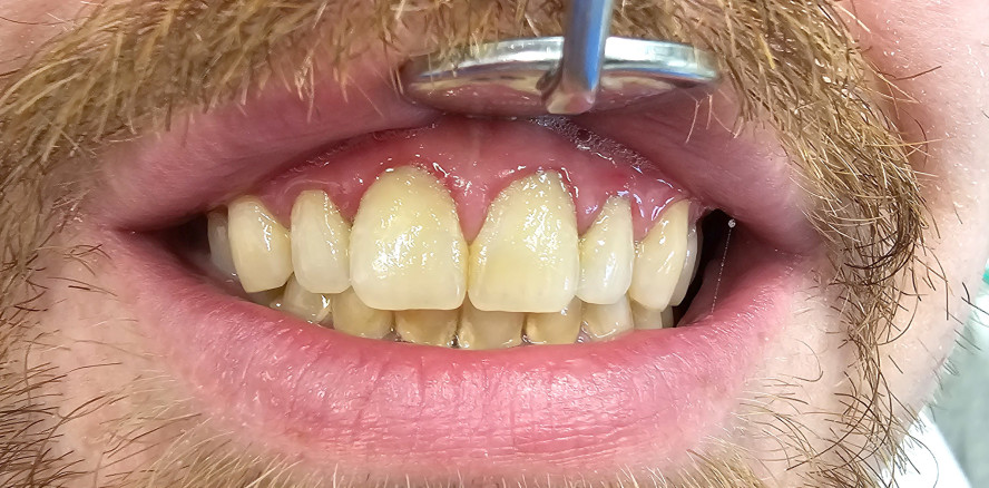 Ganzheitliches Therapiekonzept in der Mundgesundheitspflege