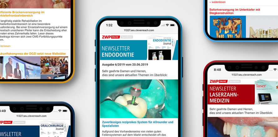 Fachlich up to date: Spezialisten-Newsletter Endodontie