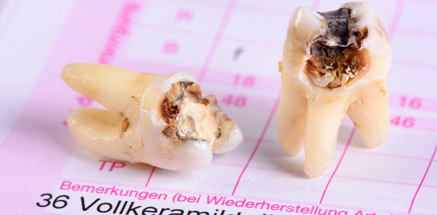 Zum 1. Juli 2022: UPDATE Digitale Planungshilfe (DPF)