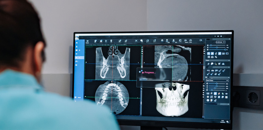Update radiologische 3D-Diagnostik und navigierte Implantatinsertion