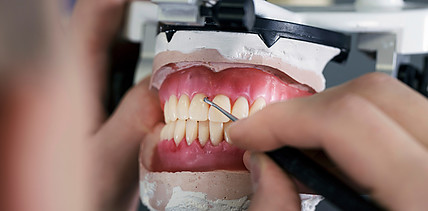 GKV-Beitragsstabilisierungsgesetz: VDZI warnt vor langfristigen Folgen für Dentallabore und Patienten