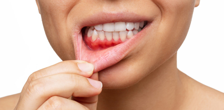 Integrierte Versorgung von Diabetes und Parodontitis